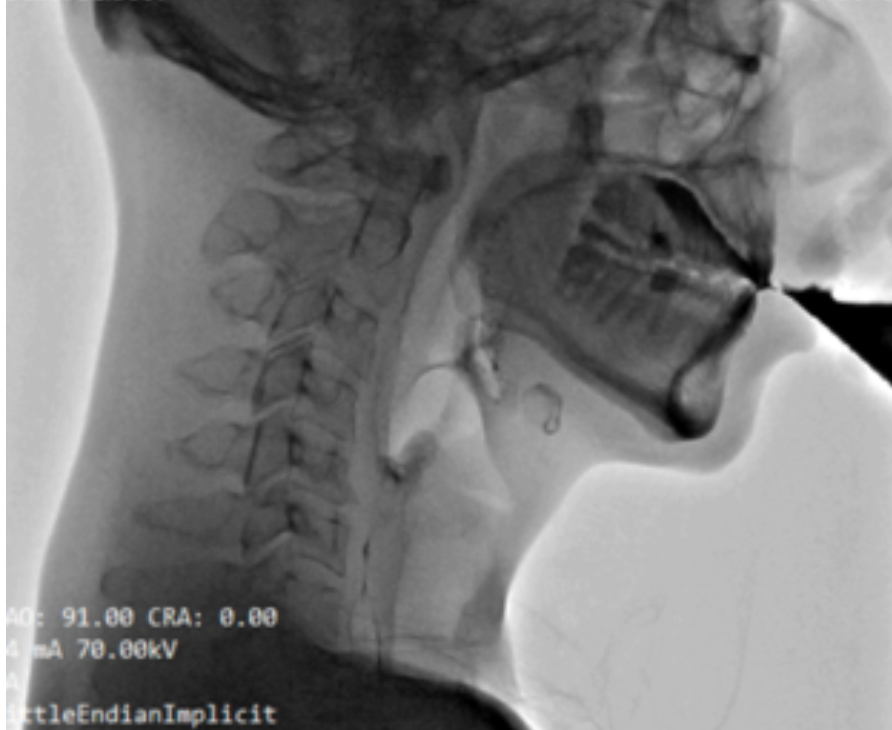 Imagem lateral de cabeza y cuello en radiologia
